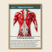 Triggerpunktsdiagram