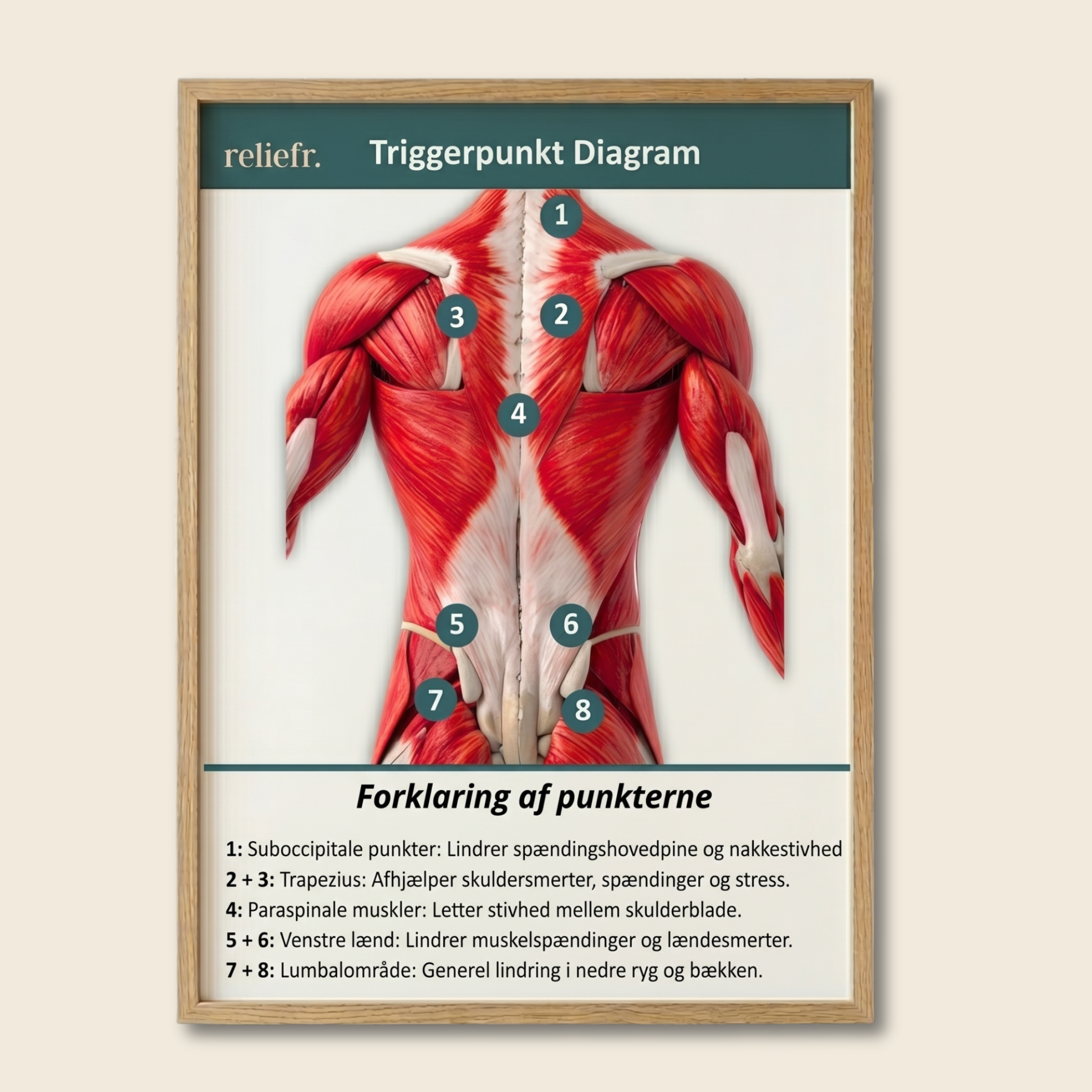 Triggerpunktsdiagram